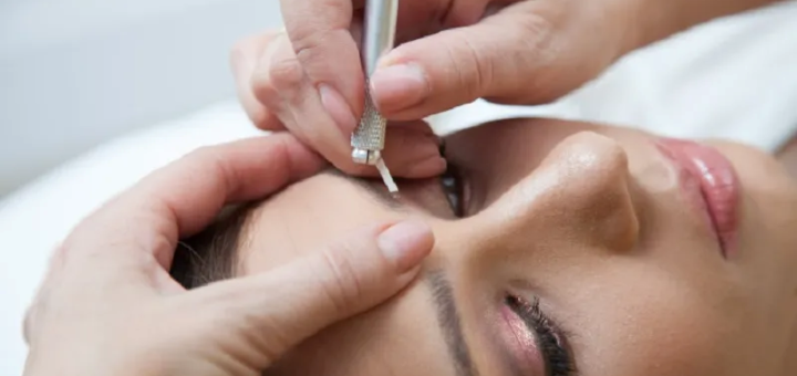 کاشت ابرو به روش FUE؛ چگونه این روش شما را شگفت‌زده می‌کند؟